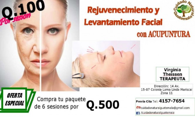 Rejuvenecimiento facial con acupuntura citas 55712394