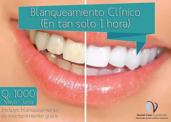 Clinica Dental Care San cristobal Blanqueamiento Dental