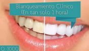 Clinica Dental Care San cristobal Blanqueamiento Dental